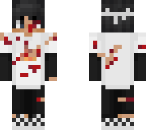 sapnap bleeding