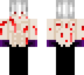 tomura shigaraki (white hair+bleeding)