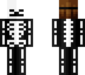fracture