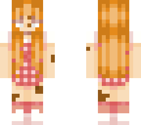 ginger vitiligo girl