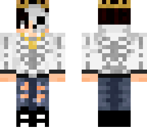 anti skeleton