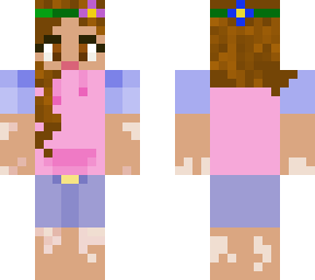 vitiligo girl