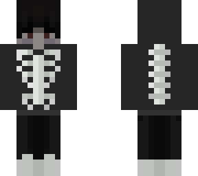skelly mm