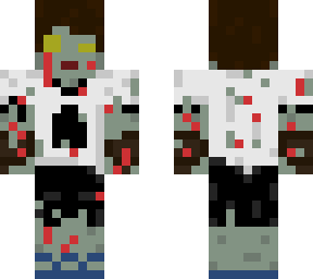 calbay zombie