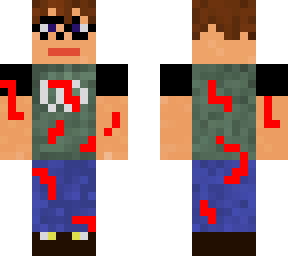 hurt simon