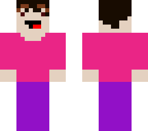 similar skin to mine for my friend