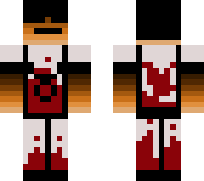 lost skin emmanuel (twins with jacob)