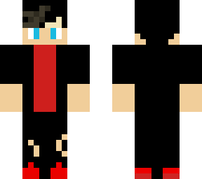 boy with scar on his head