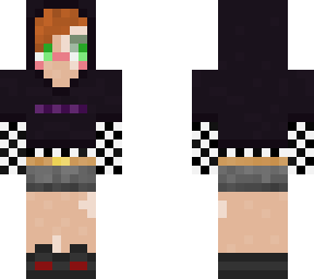 e-girl w/ vitiligo