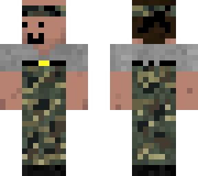 army baldness