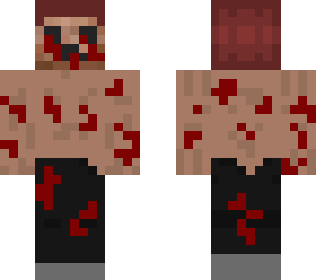 my dead skin