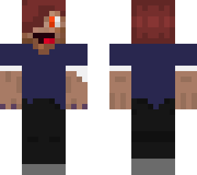 my dream skin #1