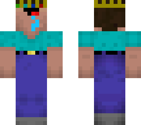 noob king