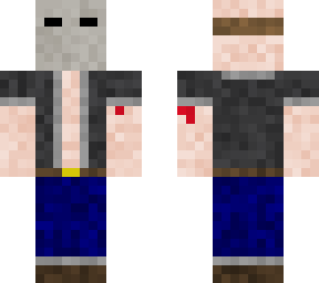 definitely a normal skin
