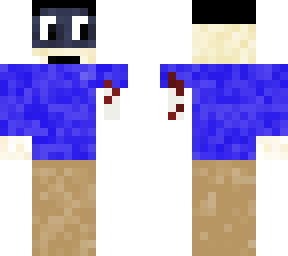lost an arm