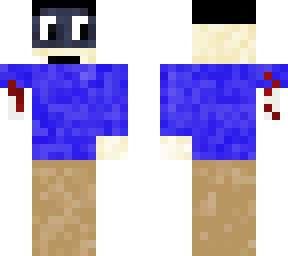 lost an arm