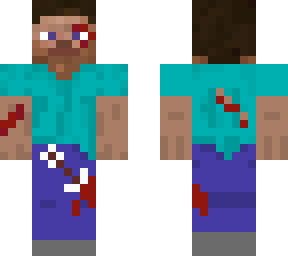 injurded steve