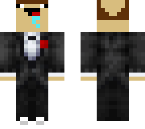 calvitie noob
