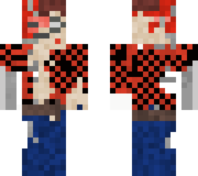 my skin