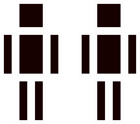 x-ray