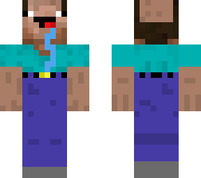 balded noob