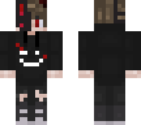 not my skin, go to soap0soup plz
