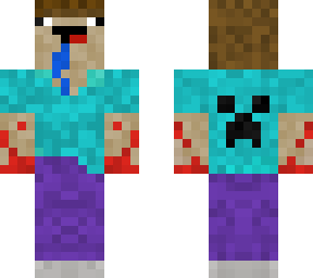 noob killer