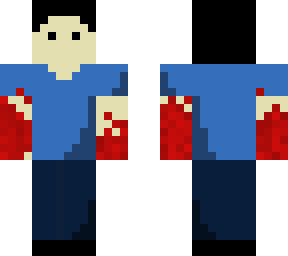 bloody hands