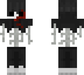dameged steel bones