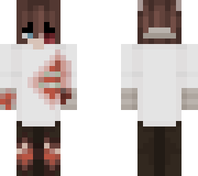 another of my skin