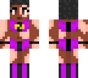 super hero girl with vitiligo