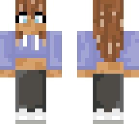 vitiligo girl