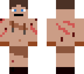 wounded island surviver