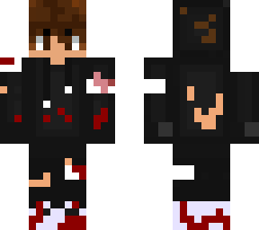 injured sonny (fixed)