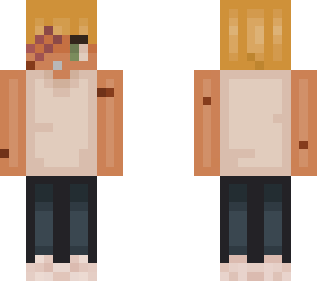 actual_arrrchie’s jeremy (post bite)