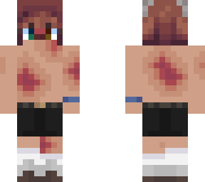 bruised mazzi