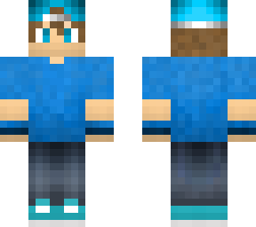 anthony skin