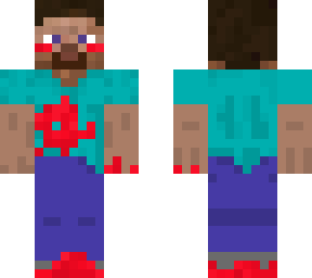 wounded steve
