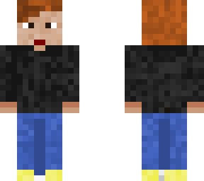 mi skin