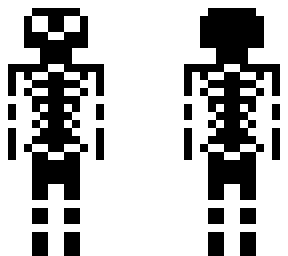 skeleton