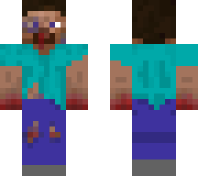 bruised up steve