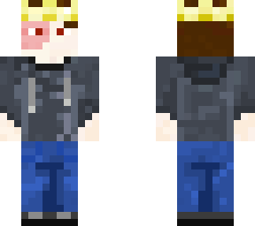 my skin