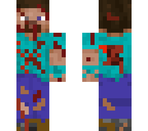 steve loses a arm?