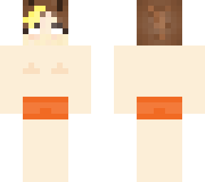 top surgery