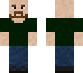 bald boy 1