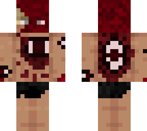the infected - stage 2