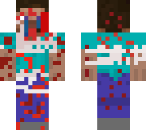 steve is dying