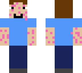 achne steve