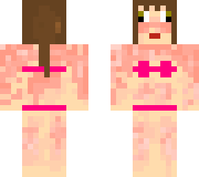 kawaii sunburn