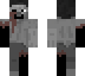 frostbite steve